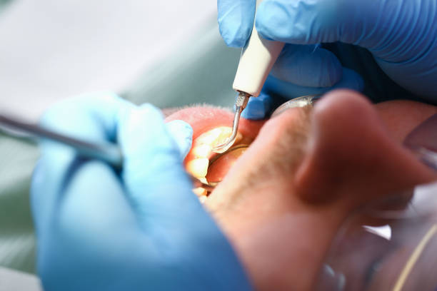 Best Emergency Dental Extractions in South Uniontown, PA
